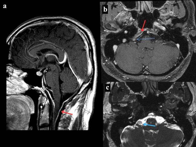 medical cases for case study