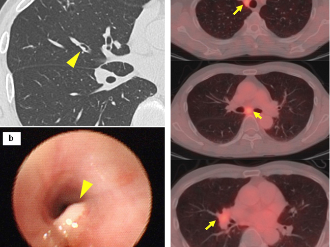 medical cases for case study