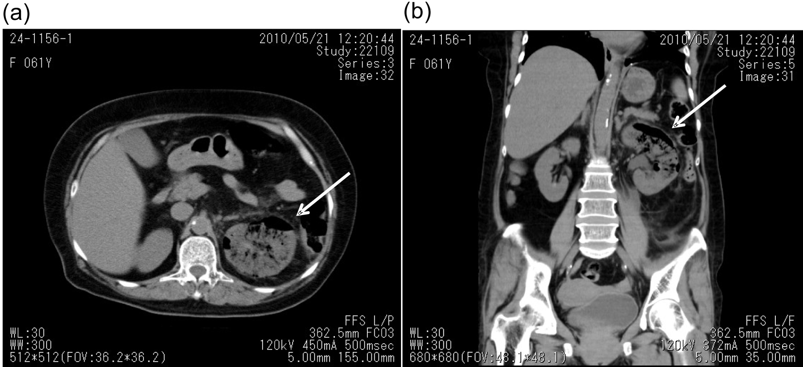 Figure 1. 