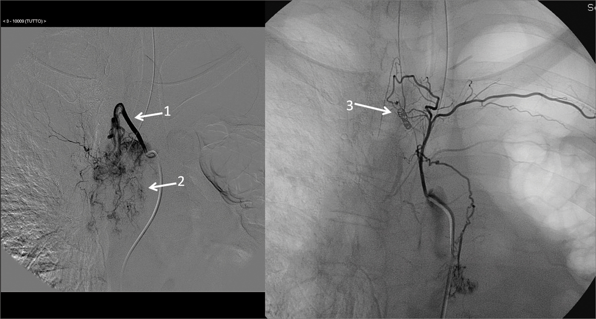 Figure 3. 