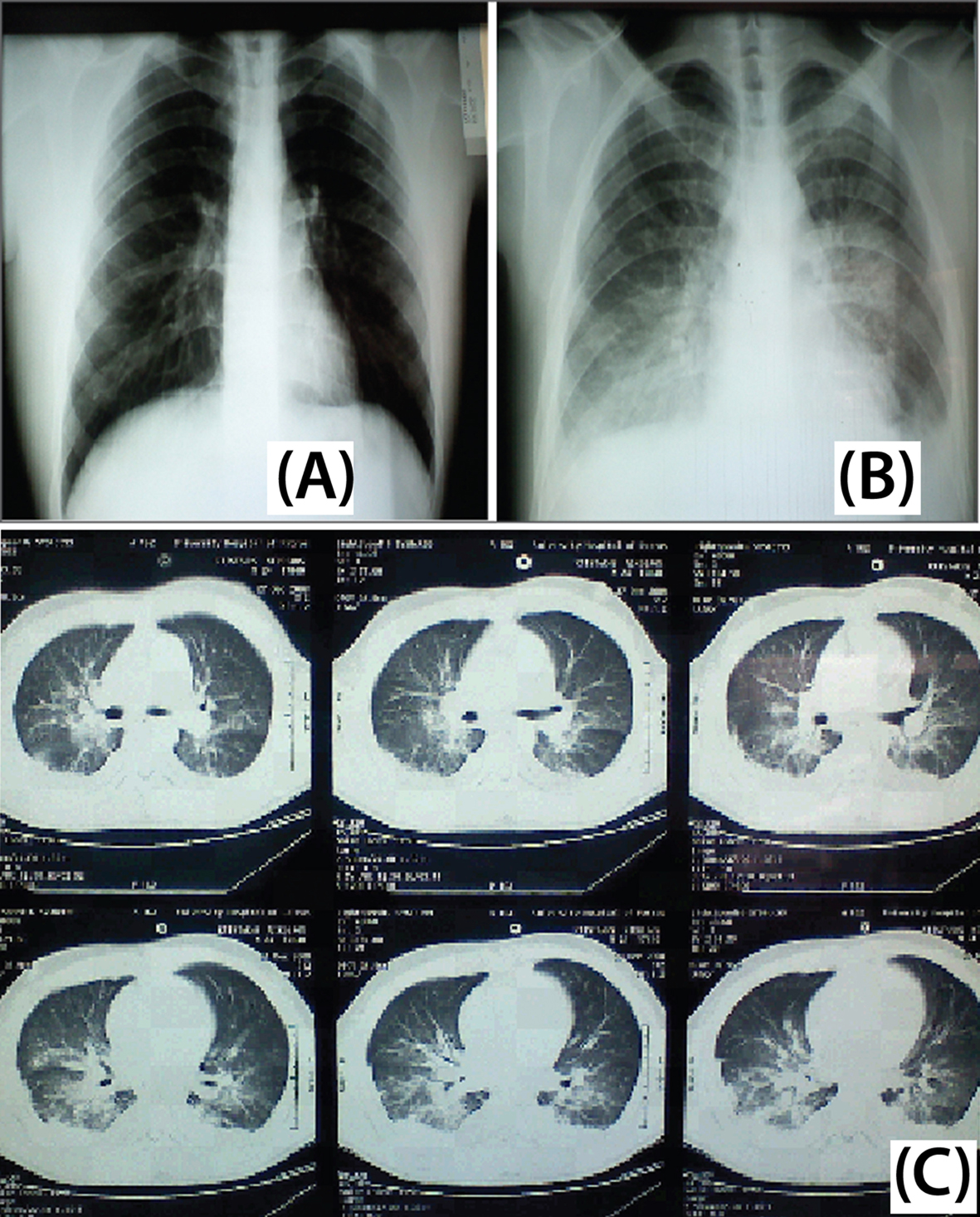 Figure 2. 