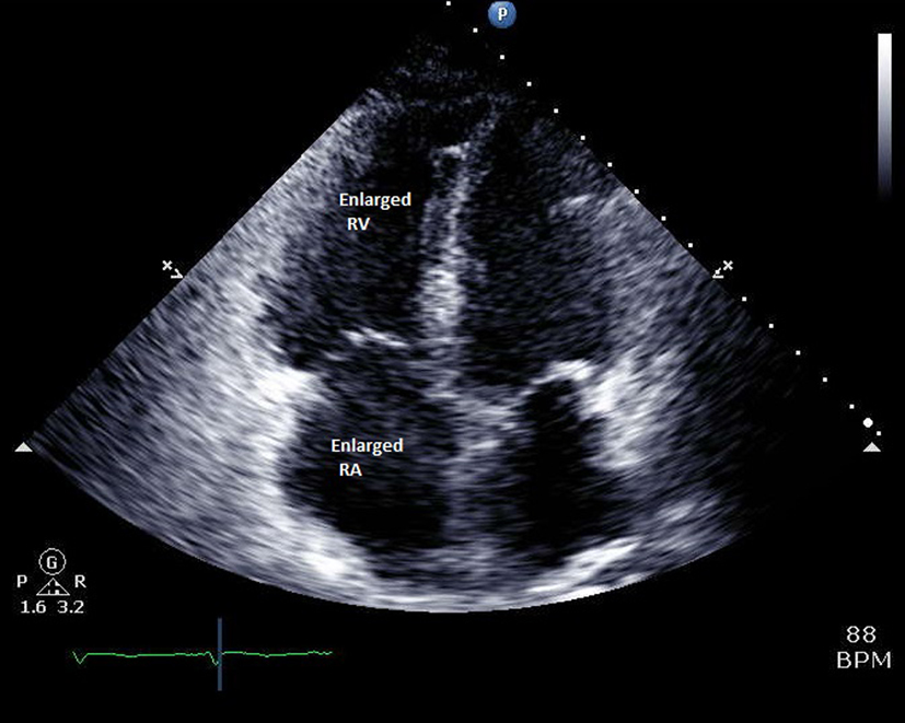 Figure 3. 