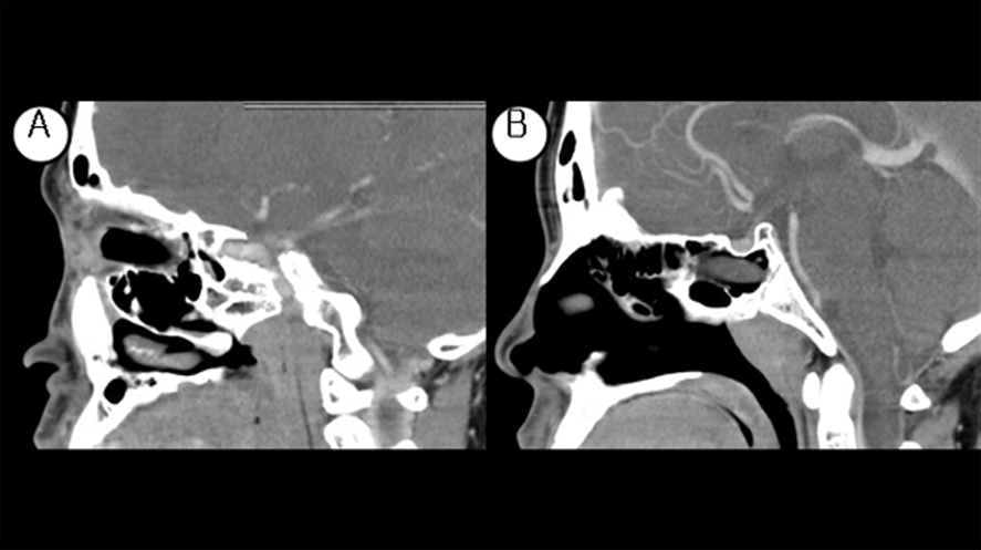 Figure 3. 