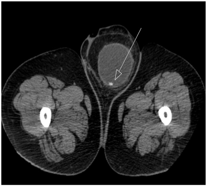 Figure 3. 