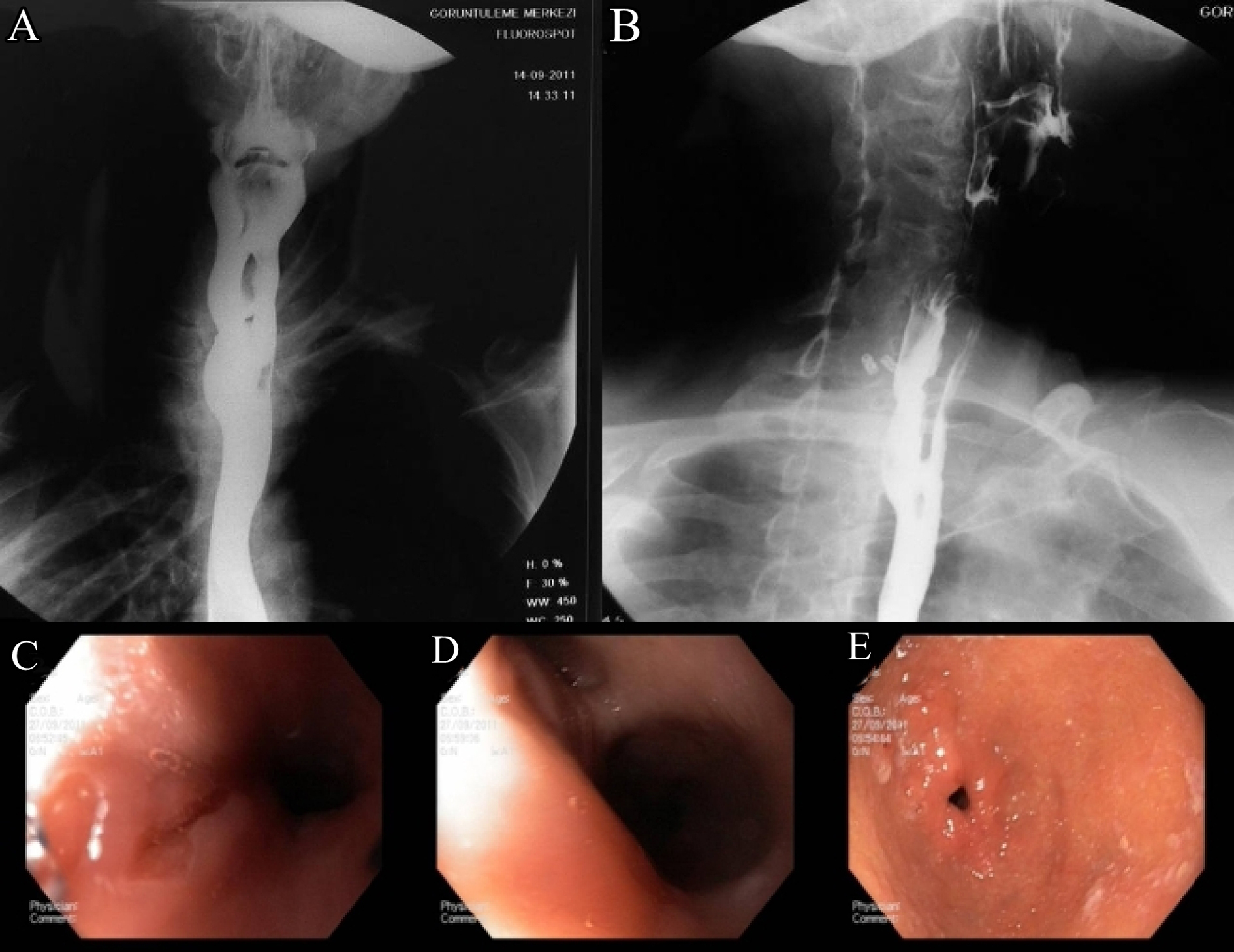 Figure 3. 