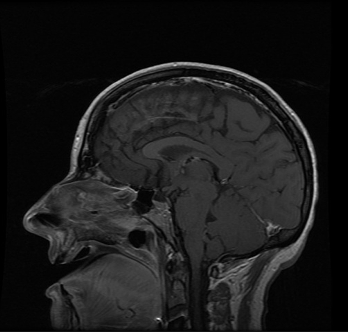 Figure 1.ExSpiron. 