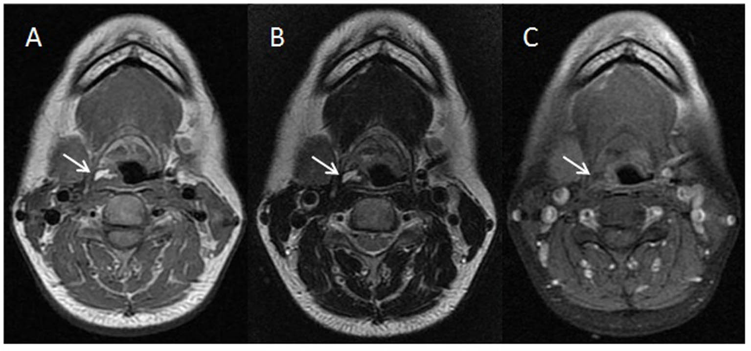 Figure 2. 