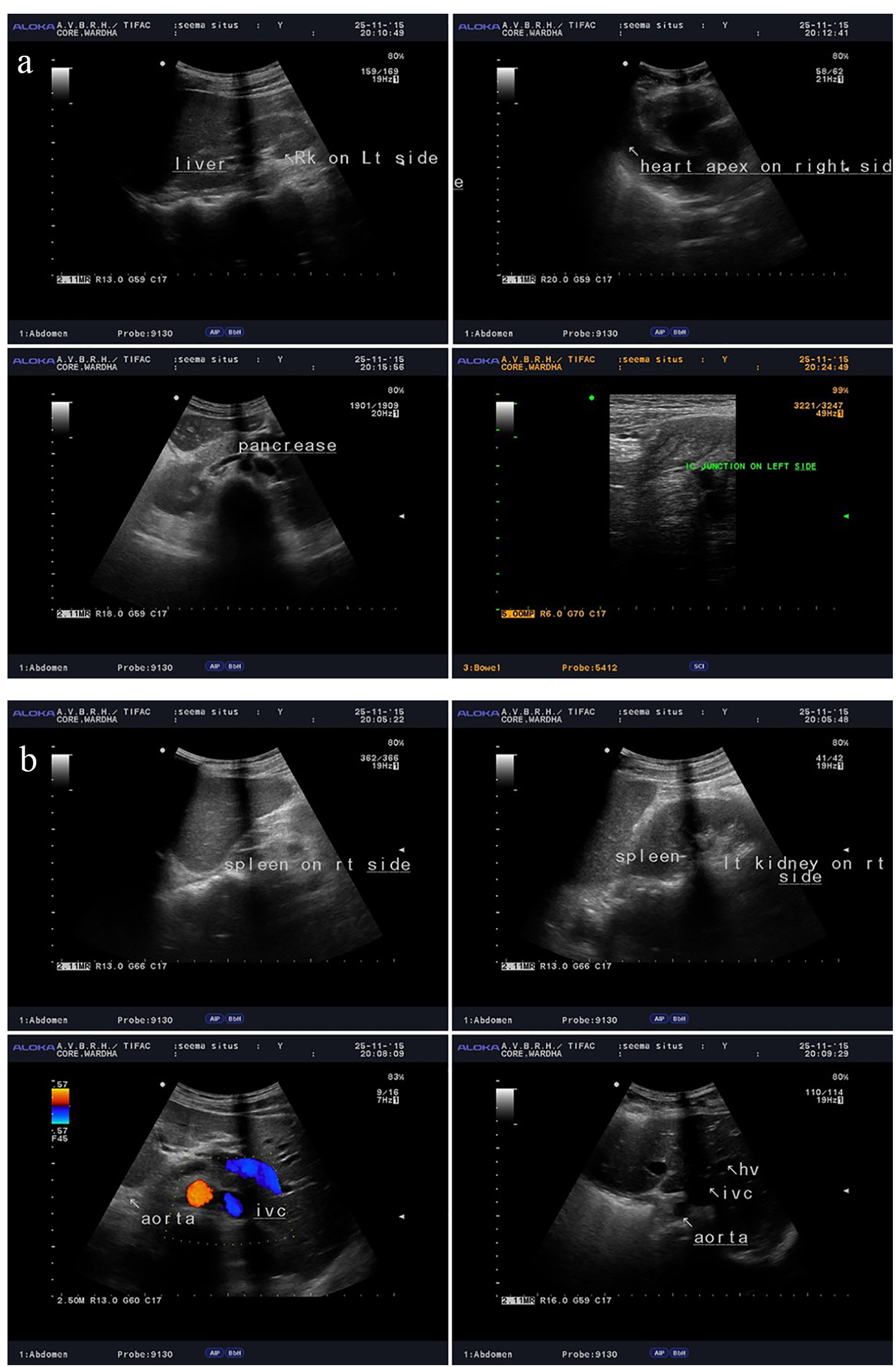 Figure 3. 