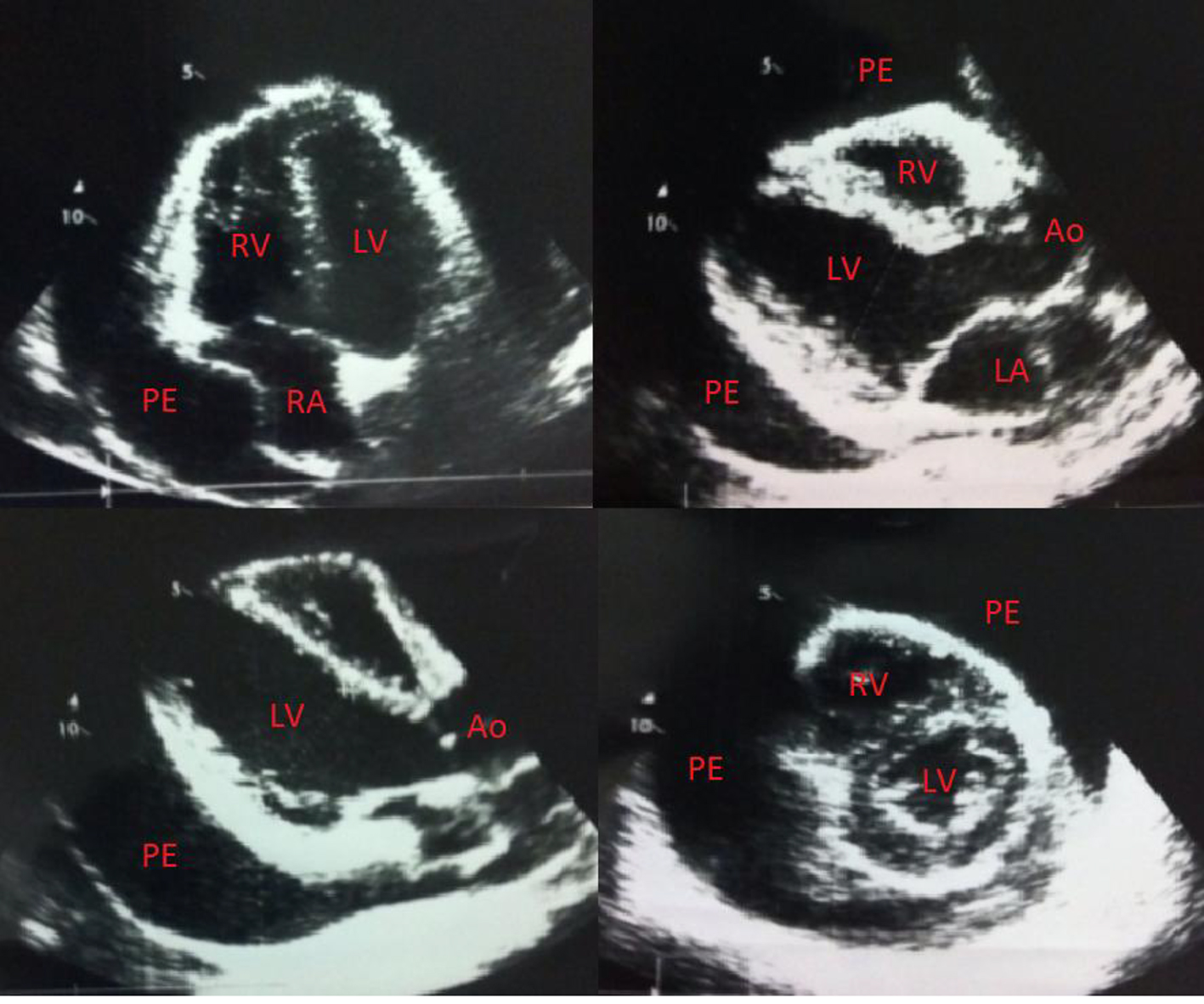 Figure 2. 