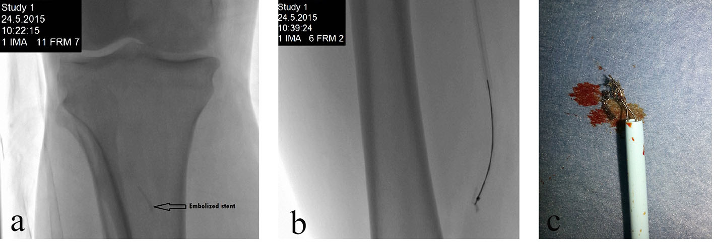Figure 2. 