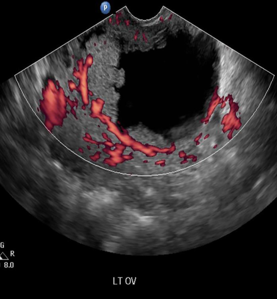 Figure 2. 