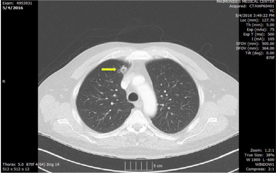 Figure 3. 