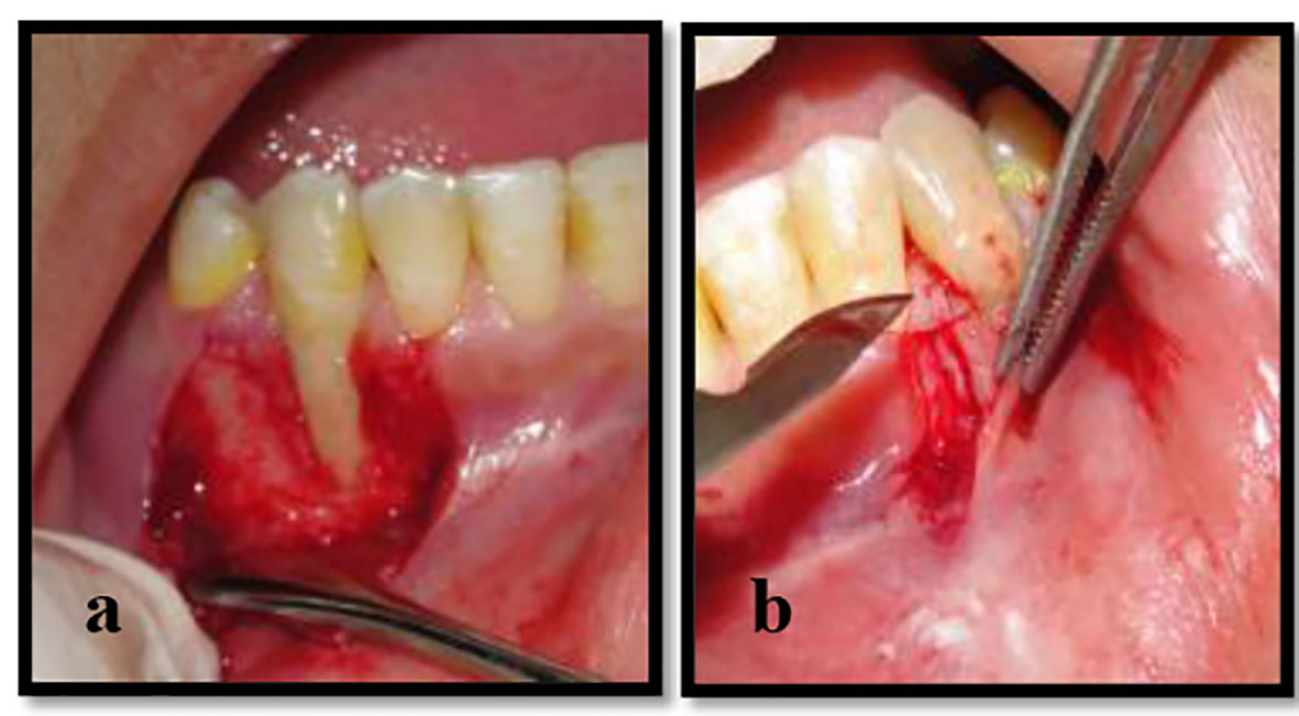 Figure 3. 