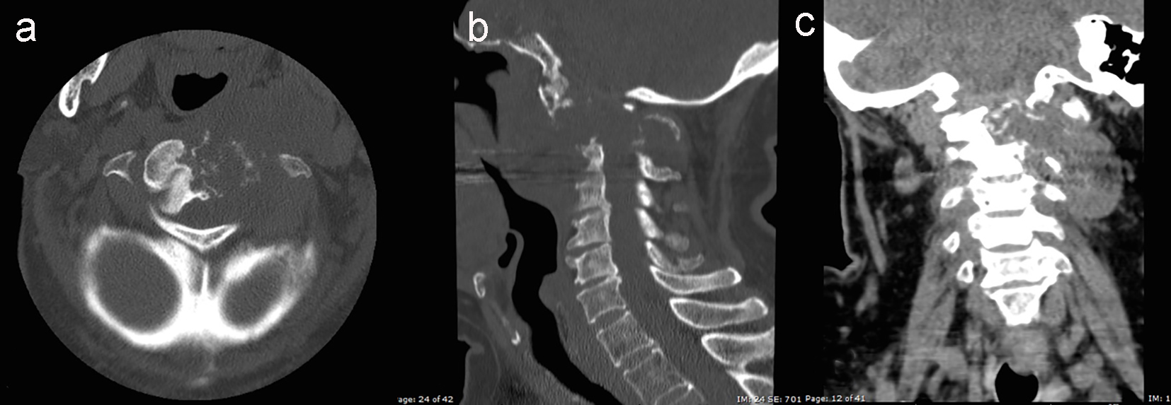 Figure 2. 