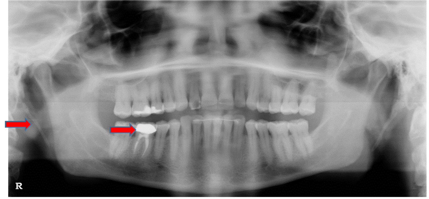 Figure 3. 