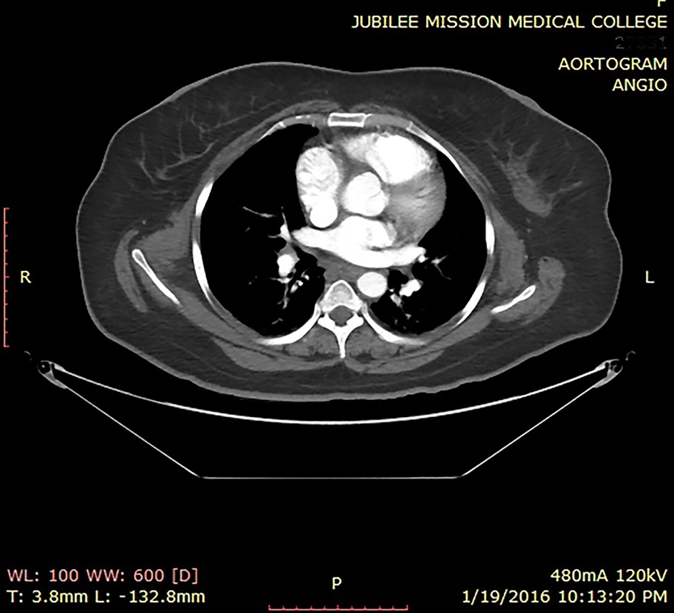 Figure 3. 