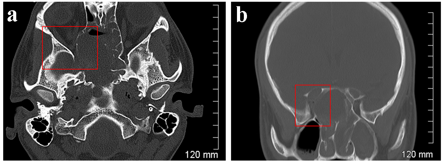 Figure 3. 