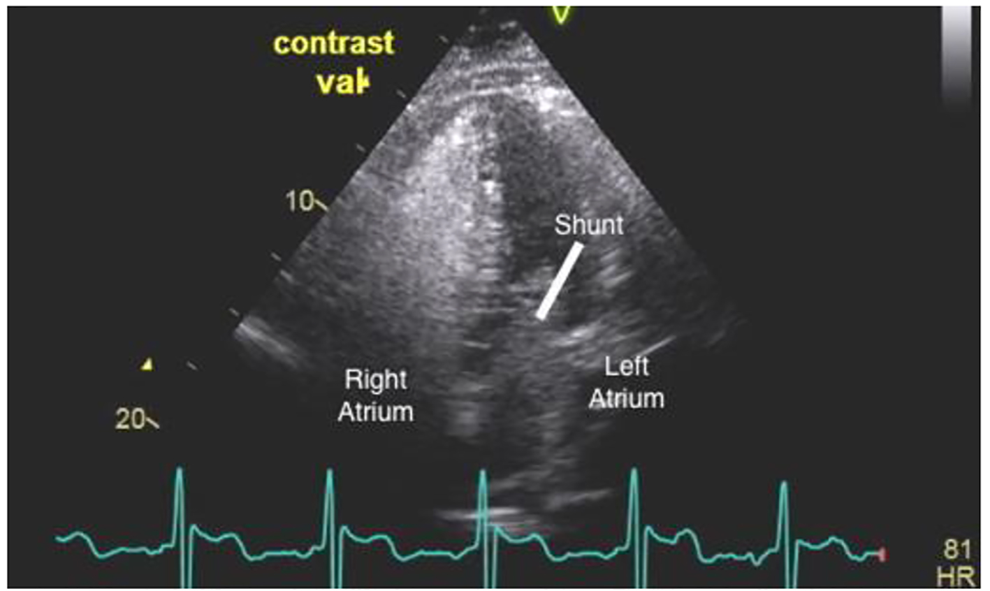 Figure 3. 