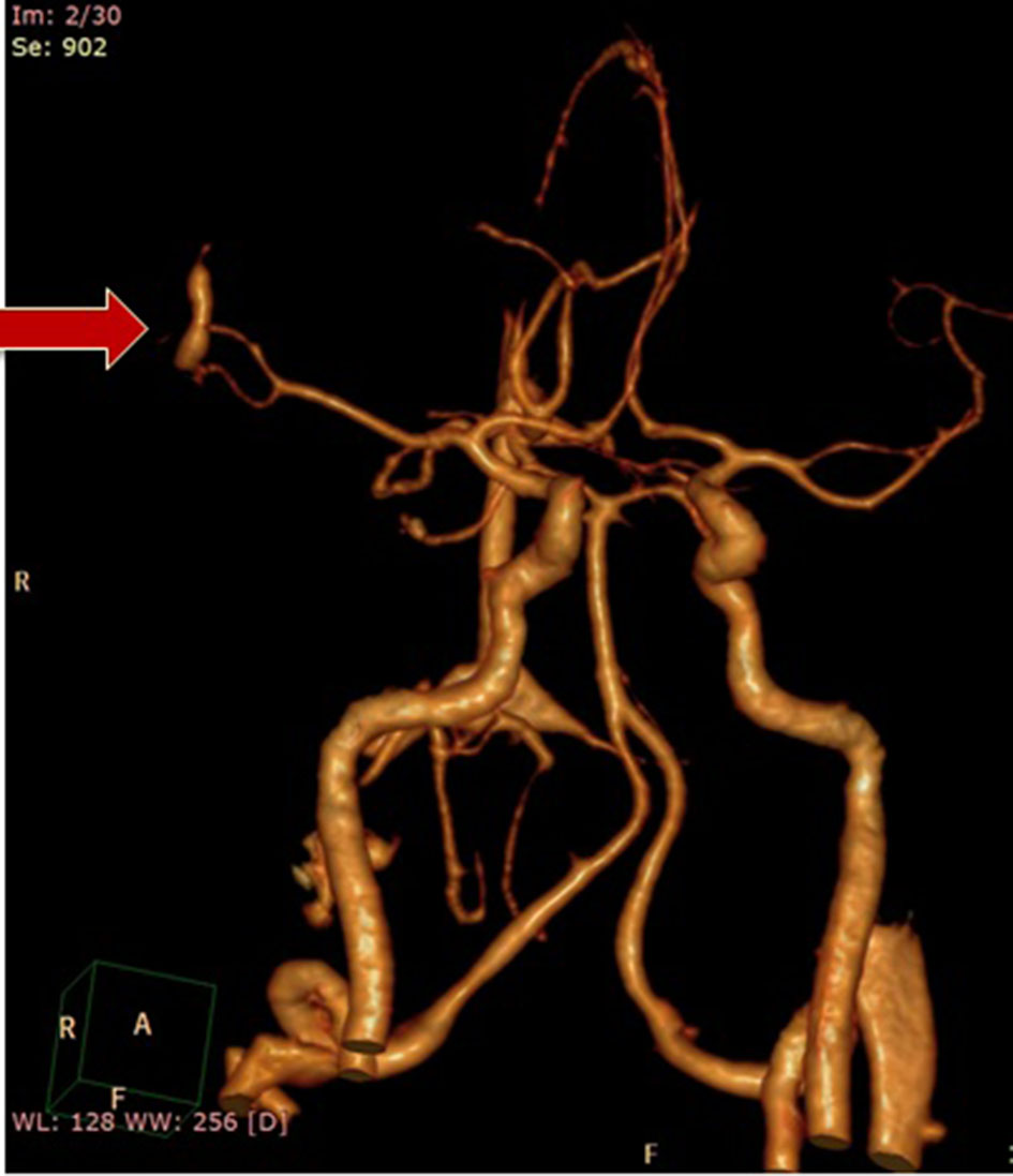 Figure 2. 