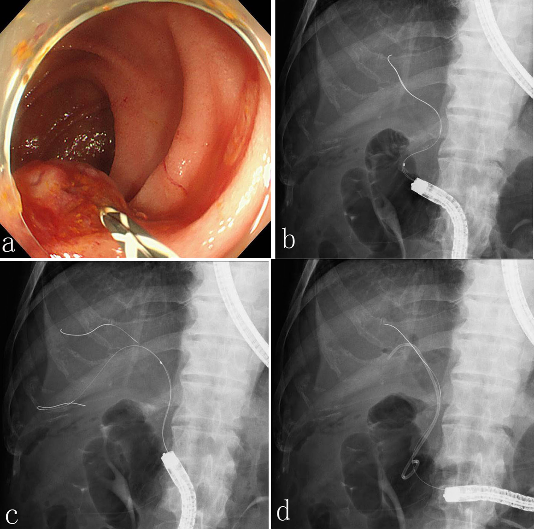 Figure 3. 