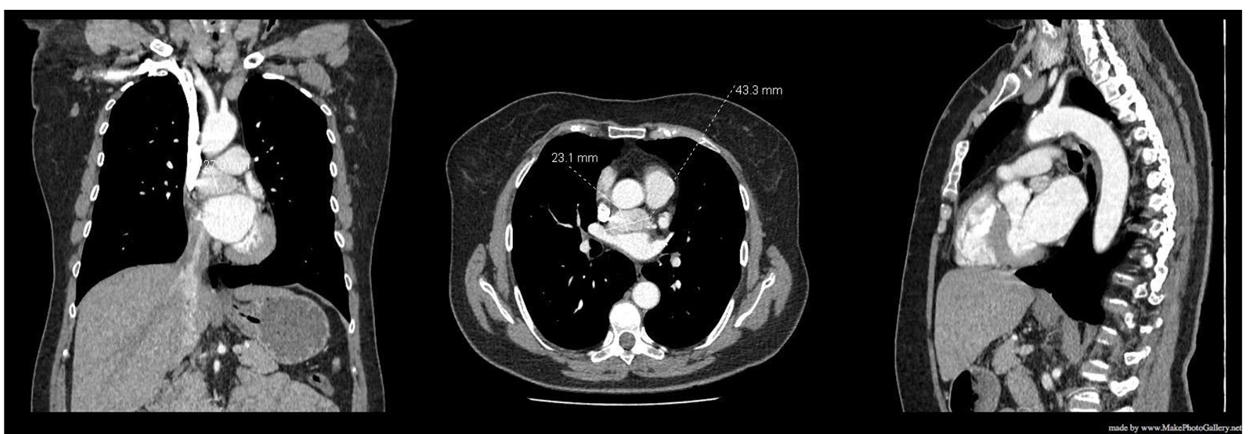 Figure 4. 