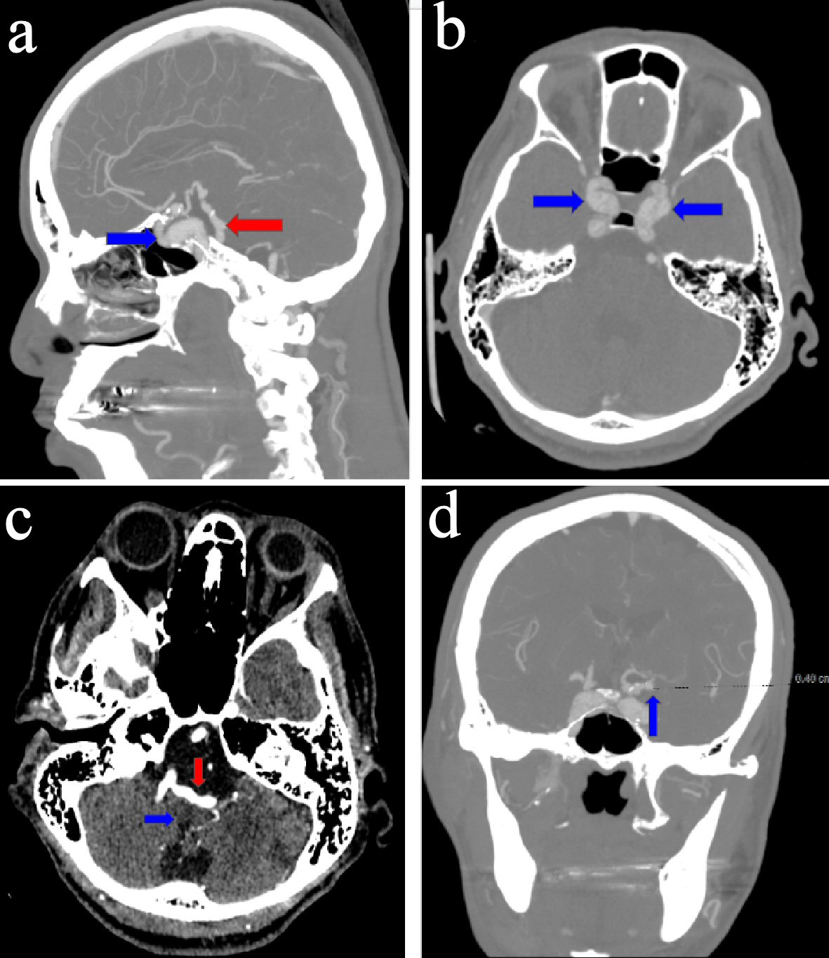 Figure 3. 