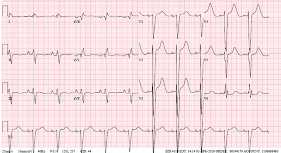 Figure 2. 