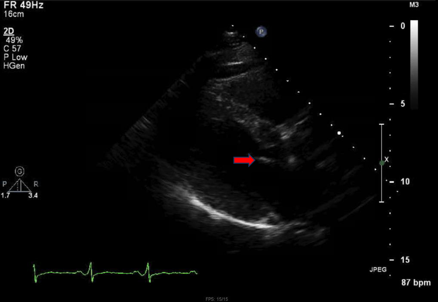 Figure 6. 