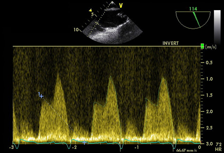 Figure 2. 