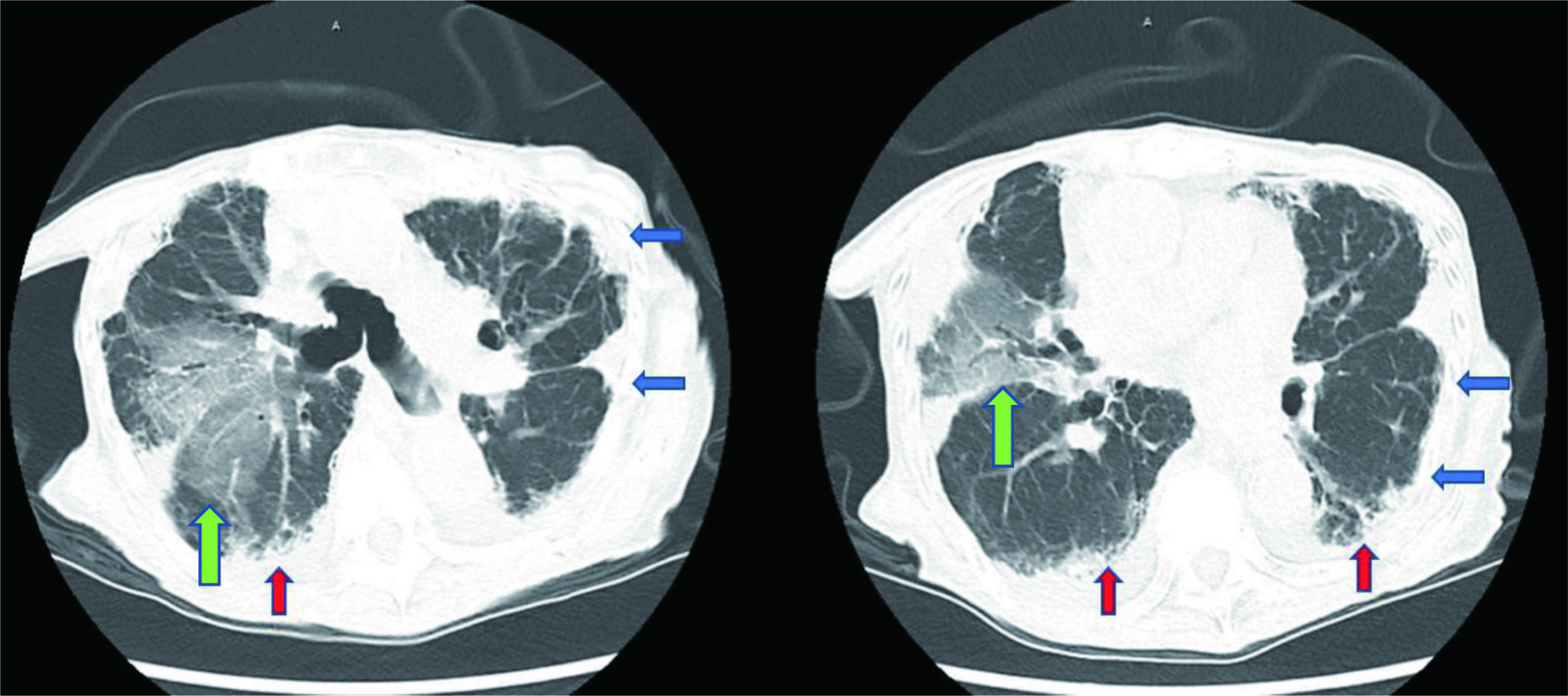 Figure 3. 