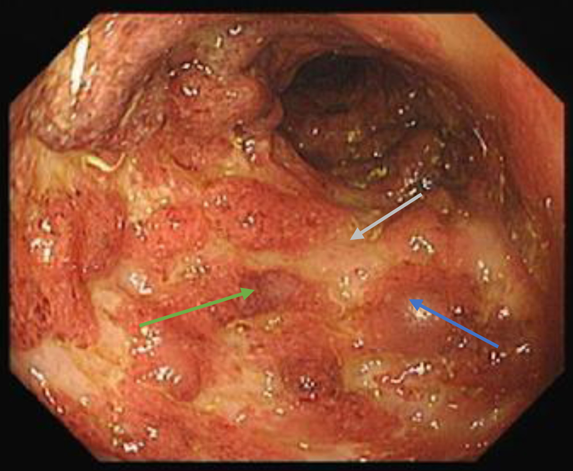 Figure 3. 