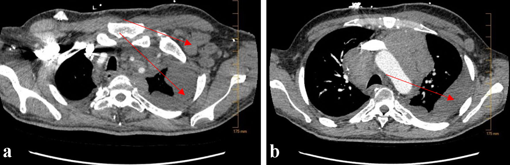 Figure 3. 