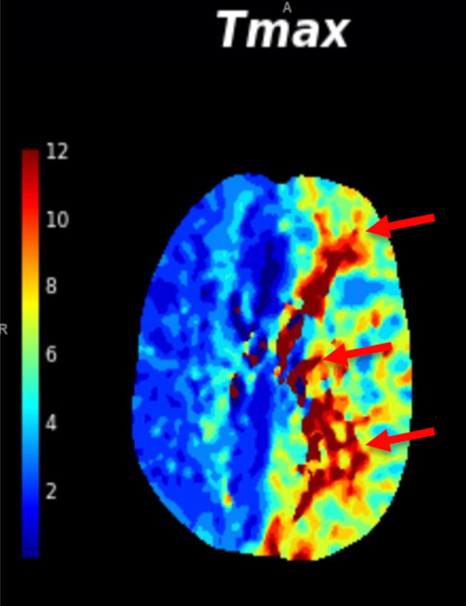 Figure 3. 