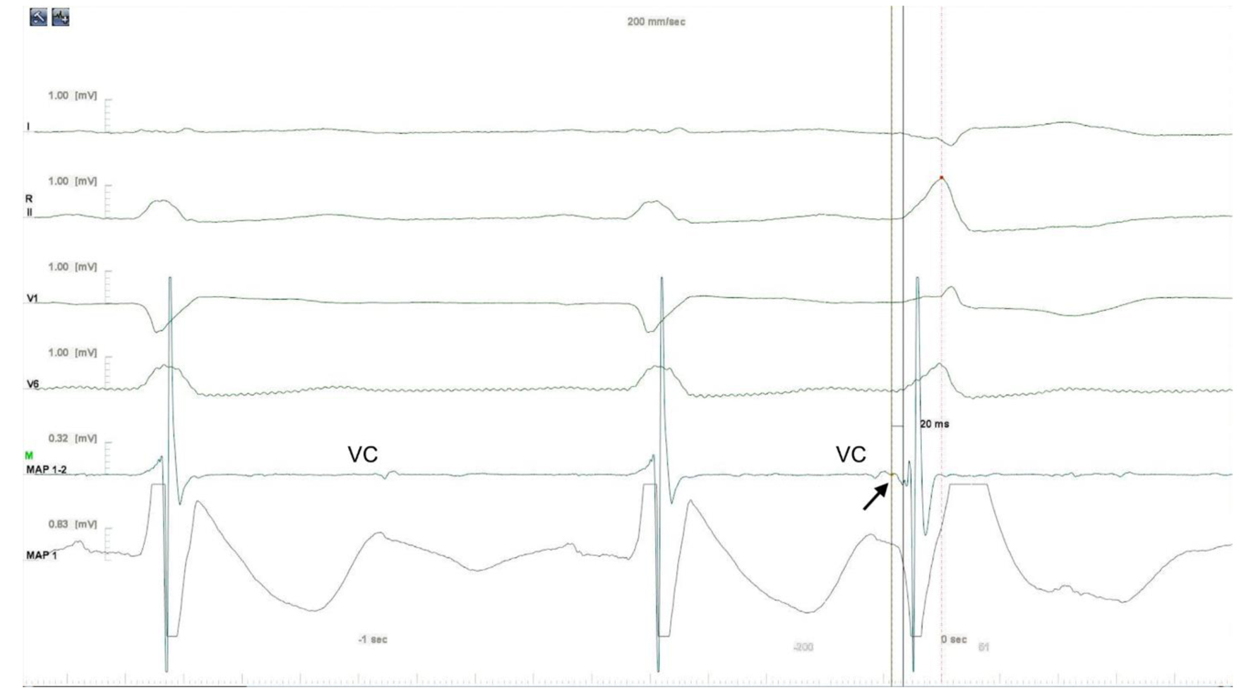 Figure 3. 