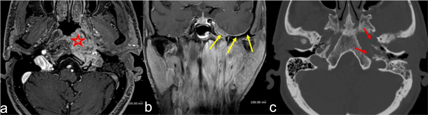 Figure 4. 