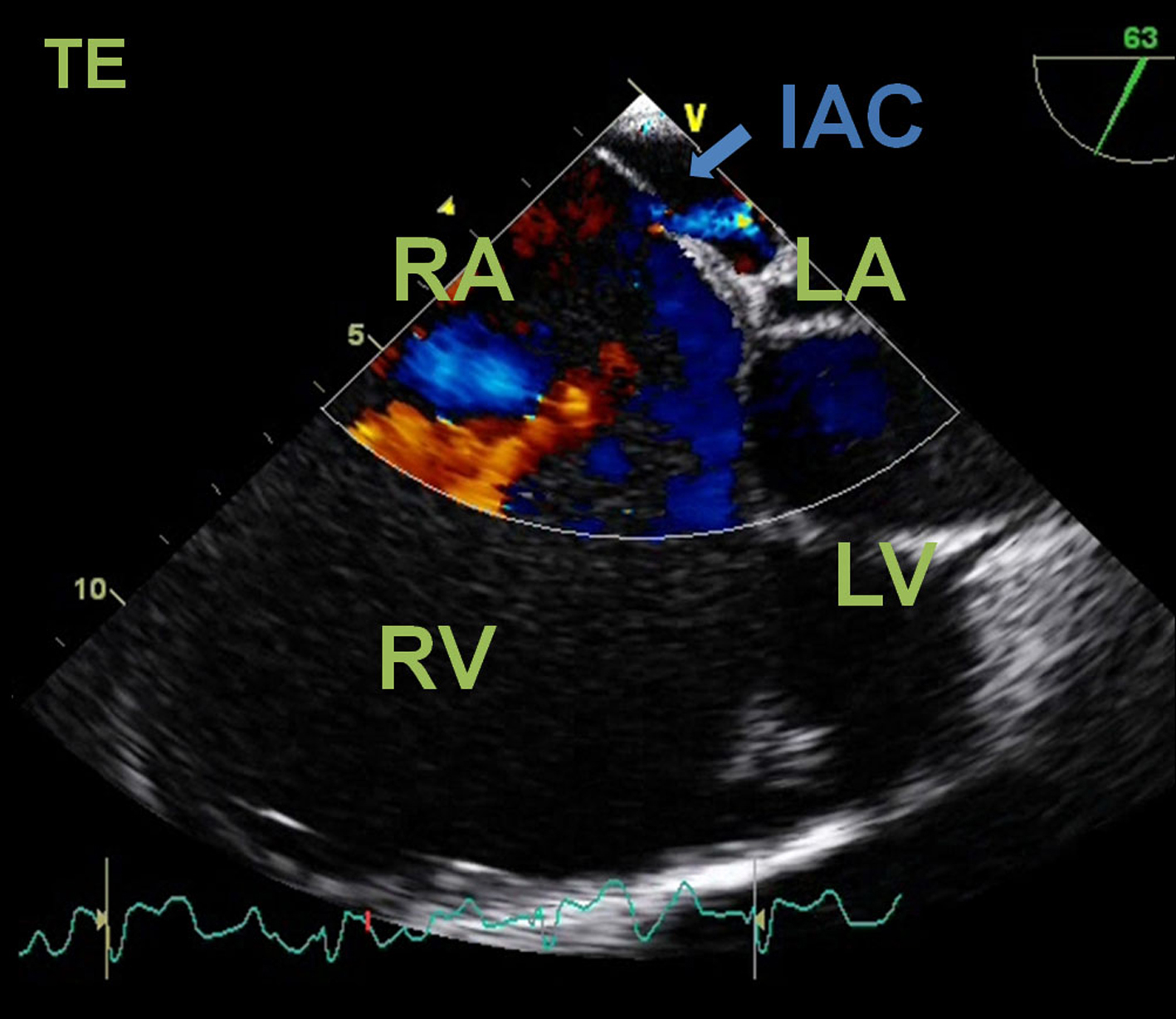 Figure 4. 