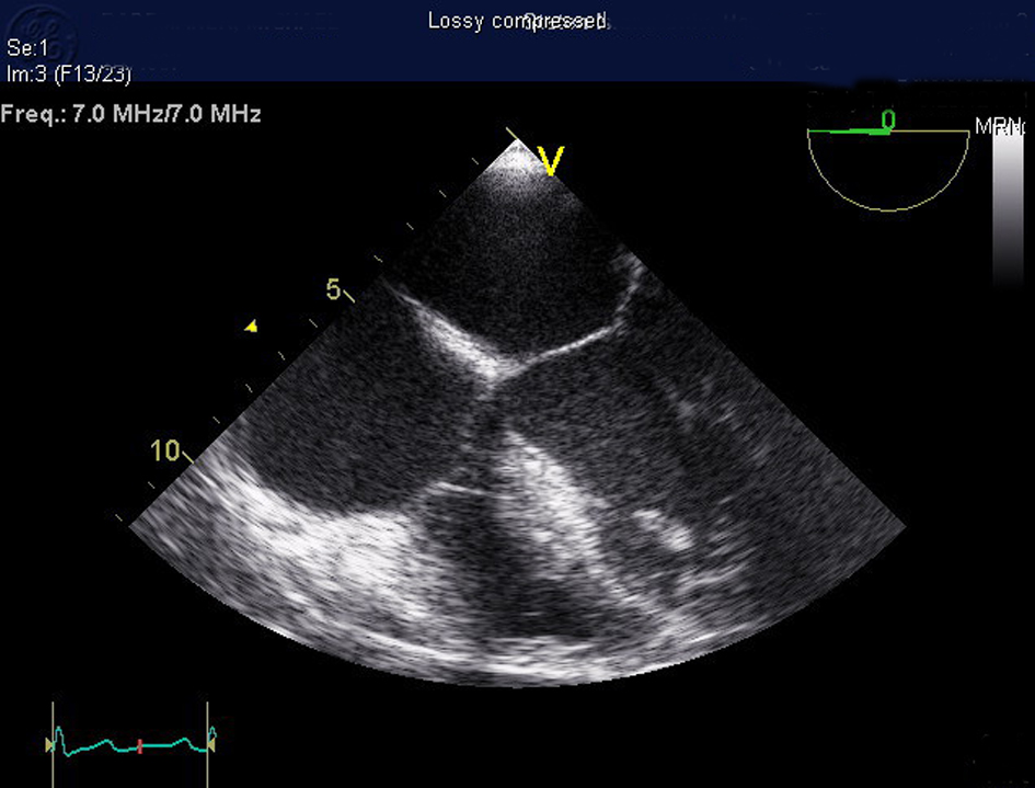 Figure 4. 