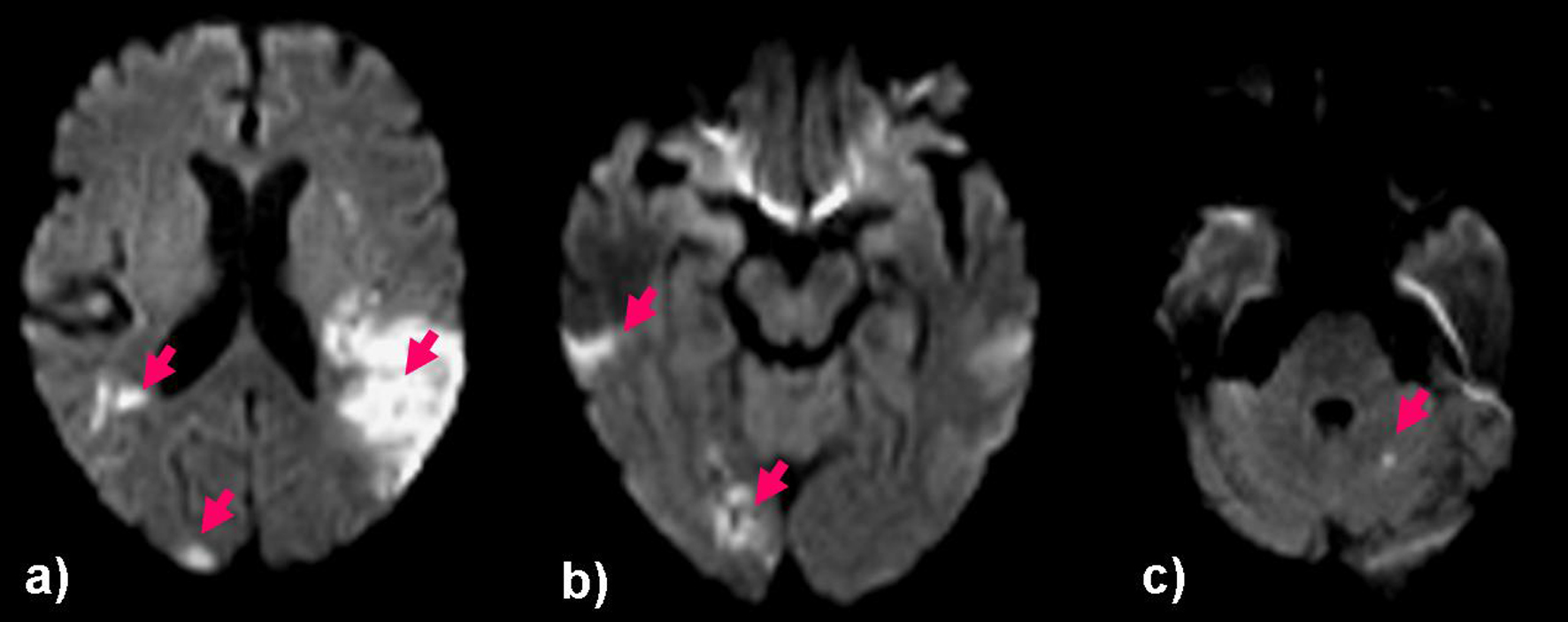 Figure 3. 