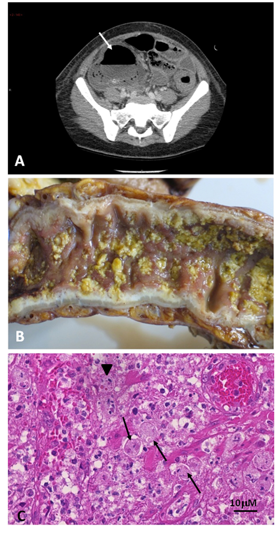 Figure 1. 